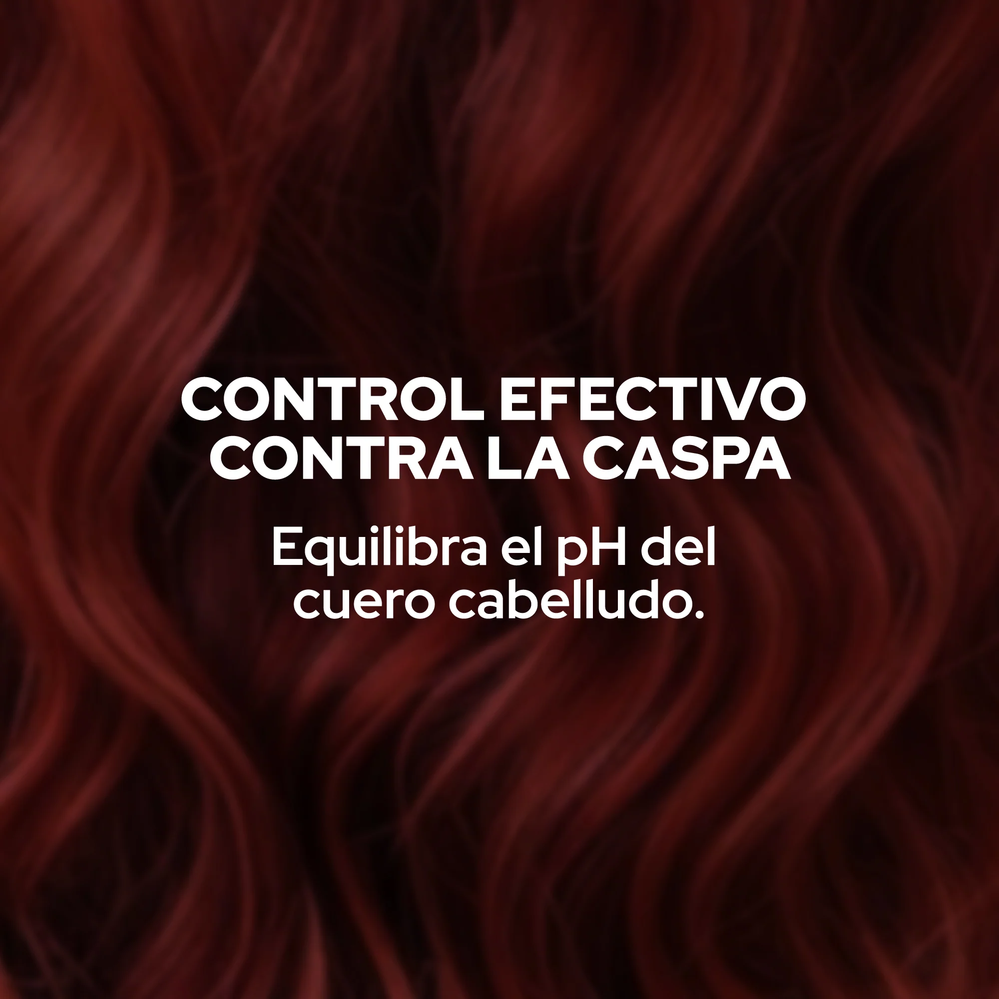 SHAMPOO ANYELUZ ANTICASPA X400ML - Imagen 3